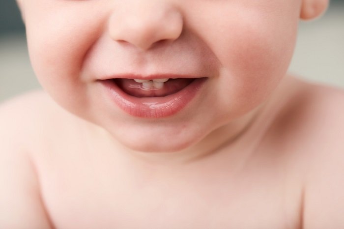 Trẻ chậm mọc răng, bố mẹ phải làm sao?